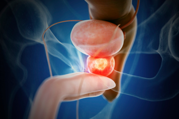 Benefits reduce cancer rate